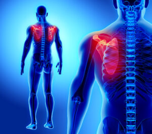 treatment and life care planning after a spinal cord injury in missouri