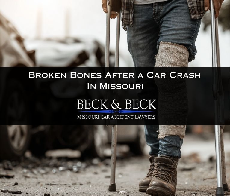 Close up of man on crutches with leg in a cast after a car crash in Missouri related to a case handled by Beck & Beck Missouri Car Accident Lawyers