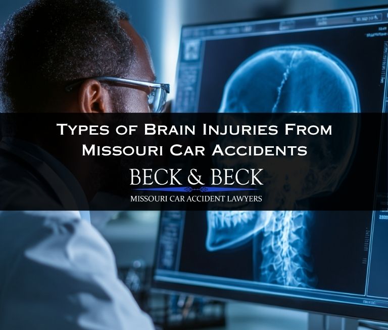 types of brain injuries from car accidents in missouri