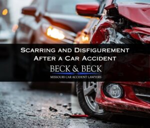 Two cars after an accident which resulted in scarring and disfigurement in a driver in Missouri