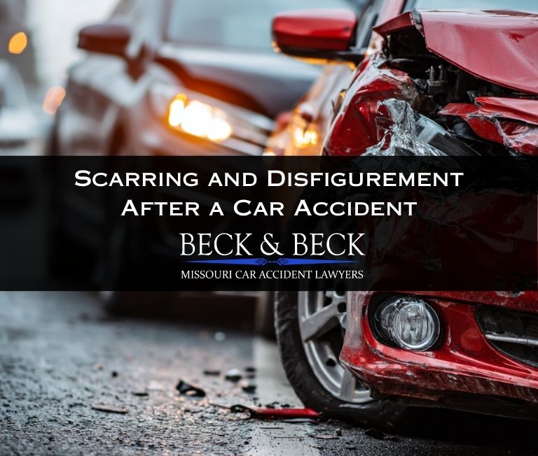 Two cars after an accident which resulted in scarring and disfigurement in a driver in Missouri