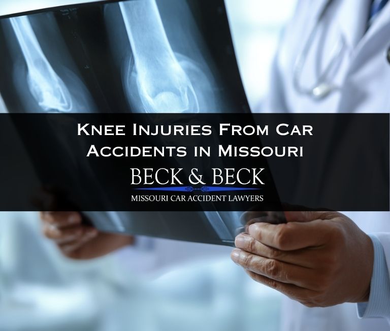 Doctor examining x-rays of a car accident victims knees in Missouri