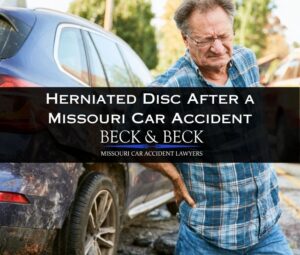 Man standing next to his crashed car in Missouri with a herniated disc in his back