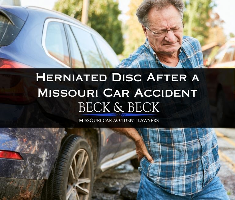 Man standing next to his crashed car in Missouri with a herniated disc in his back