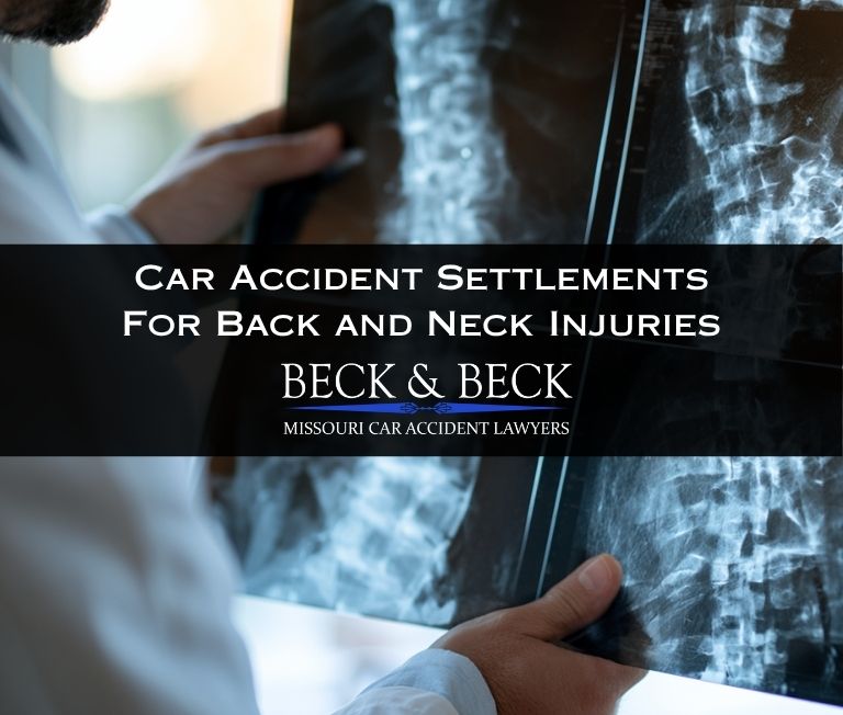 Doctor viewing x-rays of a car accident victims spine in Missouri