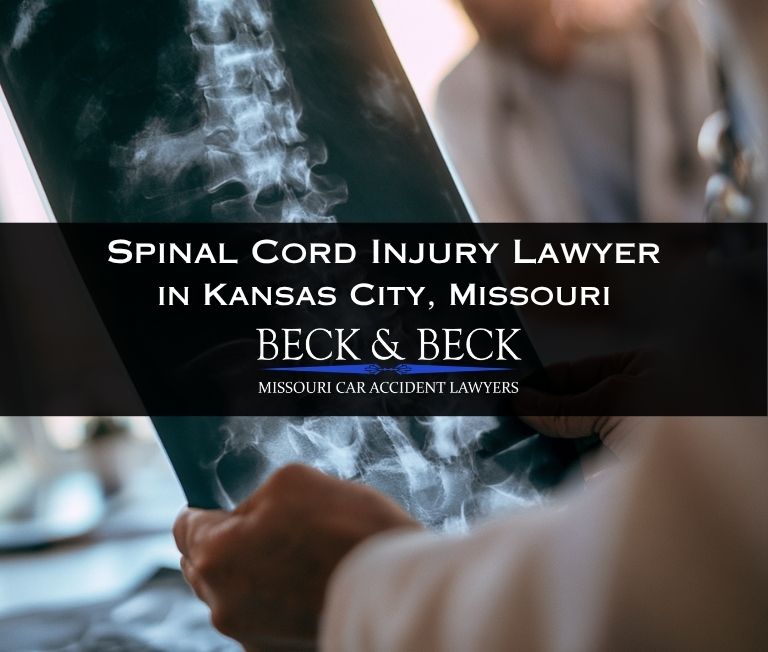 Doctor examining x-ray of car accident victims spinal cord in Kansas City, Missouri