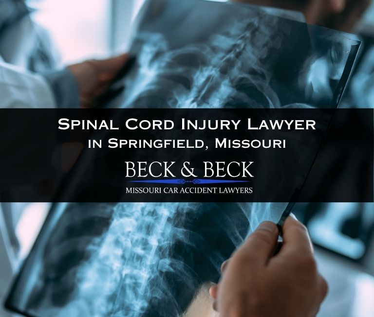 Doctor viewing x-ray of car crash patients spinal cord in Springfield, Missouri